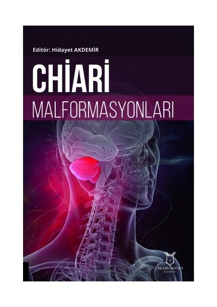Chiari Malformasyonları
