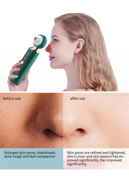 Elektrikli Siyah Nokta Temizleyici USB Şarj Edilebilir Yüz Siyah Nokta Temizleme Aleti Erkekler ve Kadınlar Için Beyaz (Yurt Dışından) indirimleri