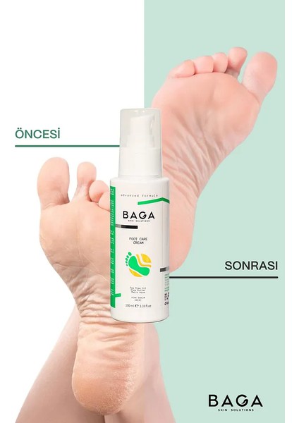 Baga Çay Ağacı Yara ve Çatıak Onarıcı Topuk Ayak Bakım Kremi 100 ml fırsatları
