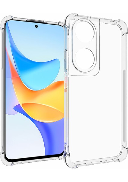 Honor Play 50 Plus 5g/play 8t 5G/X7B 4g/90 Akıllı Tpu Kılıf Esnek Cep Telefonu Kılıfı (Yurt Dışından)