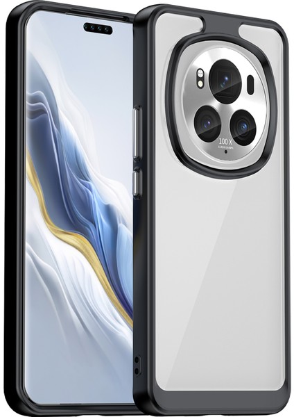 Honor Magic6 Pro 5g Tpu+Akrilik Kılıf Şeffaf Arka Telefon Kılıfı-Siyah (Yurt Dışından)