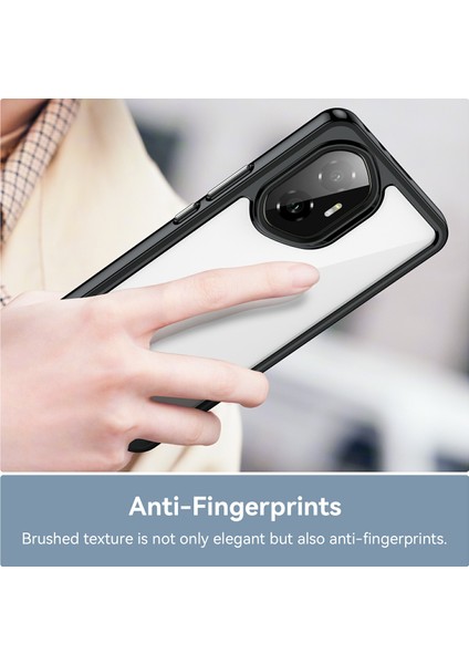 Honor 300 Kılıf Tpu+Akrilik Koruyucu Şeffaf Telefon Kılıfı-Siyah (Yurt Dışından) indirimleri