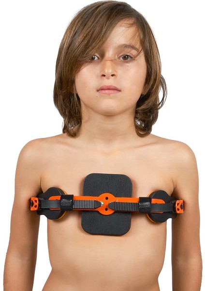 WP953 Pectus Carinatum Ortezi Dinamik