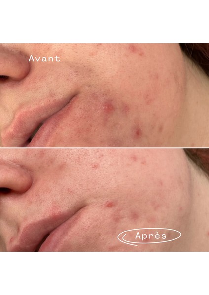 Phaze Clarifying Face Wash - Yüz Temizleme Jeli 28 ml modelleri