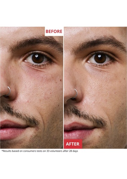 Skin Therapy - Çoklu Mükemmelleştirici Gece Serumu 10 ml modelleri