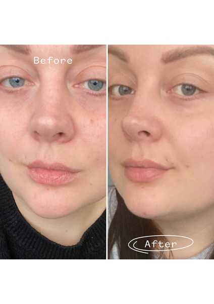 Bıoregenerate - Kuşburnu Yağı 30 ml fırsatları