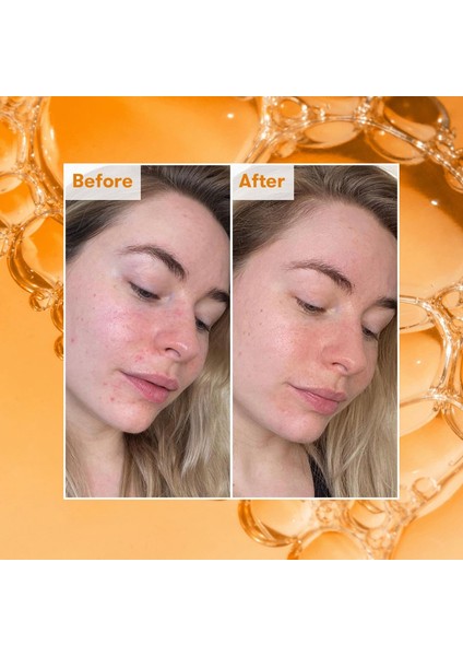 Lotion Tonique Aha Ready Steady Glow 100 ml fiyatları