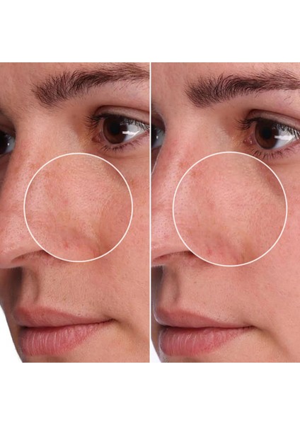 The Porefessional Shrink Wrap - Aha+Pha Içeren Cilt Bakım Jeli 50 ml modelleri