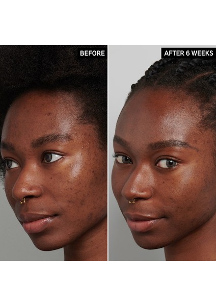 Tranexamic Acid Hyperpigmentation Night Treatment - Cilt Eşitleyici Gece Bakımı 30 ml fırsatları