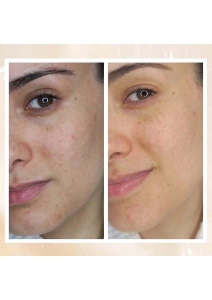 Radiance Overnight Glow Dark Spot Cream - Siyah Nokta Kremi 50 ml modelleri