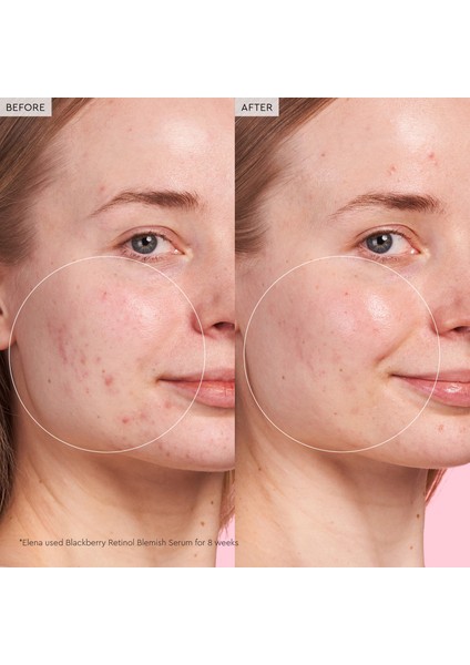 Blackberry Retinol – Yenileyici Serum 30 ml fırsatları