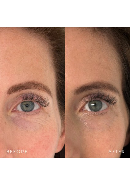 Black Tea Advanced Age Renewal Cream - Yaşlnm Karşıtı Nemlendirici Krem 50 ml modelleri