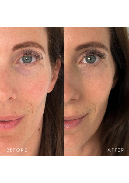 Black Tea Advanced Age Renewal Cream - Yaşlnm Karşıtı Nemlendirici Krem 50 ml fırsatları