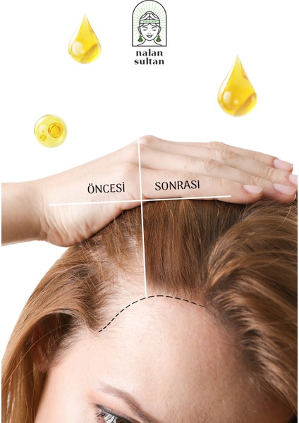 | Biberiye Yağlı Saç Dökülmesine Karşı Saç Besleyici ve Güçlendirici Serum (50ml) modelleri