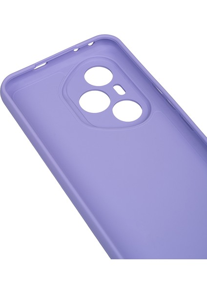 Honor 400 Pro Kılıf Zore Biye Silikon - Lacivert