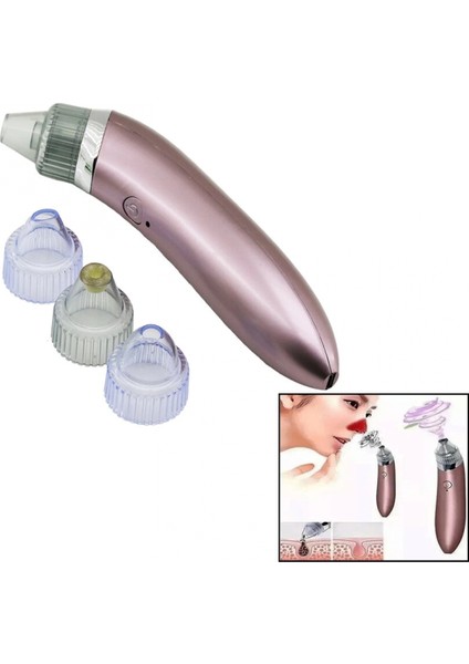CİLT BAKIM ALETİ VAKUMAKNE GÖZENEK TEMİZLEME - SİVİLCE ÇIKARMAUSB ŞARJ- 4BAŞLIK (4887)