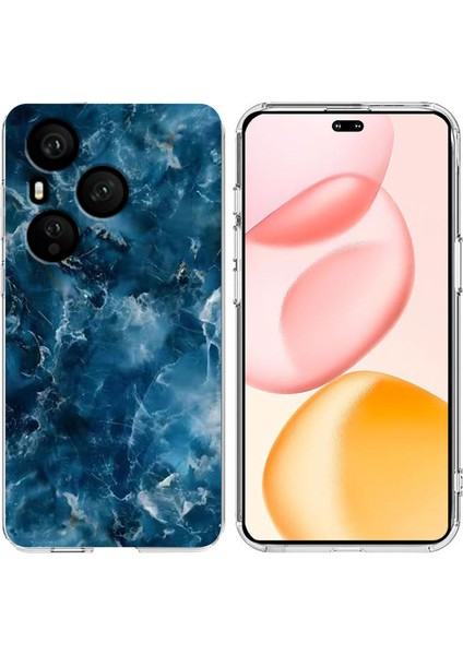 Honor 400 Pro 5g Yumuşak Tpu Telefon Kılıfı (Yurt Dışından)