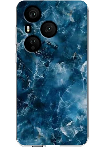 Honor 400 Pro 5g Yumuşak Tpu Telefon Kılıfı (Yurt Dışından) fiyatları