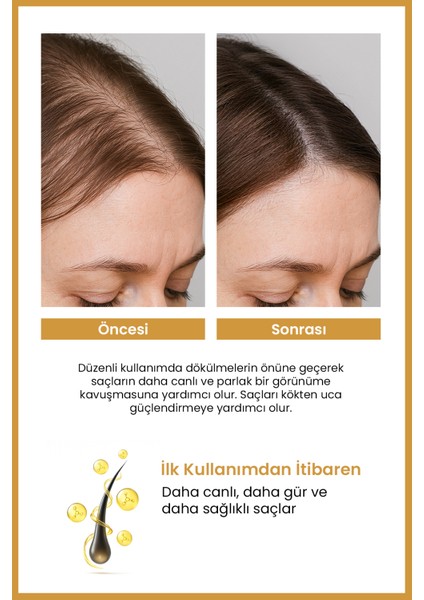 Dökülen , Geç Uzayan Saçlar için Zenginleştirilmiş 8 Aktif İçerikli Şampuan 400 ml indirimleri