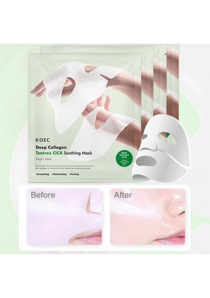 Bio Kolajen Şeffaflaşan Yüz Maskesi Cilt Yatıştırıcı Akne Karşıtı -Teatree Cıca Soothing 4ADET fırsatları