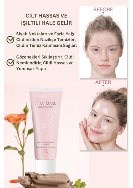Kil Yüz Maskesi Güllü Derin Temizleme, Cilt Aydınlatma ve Nemlendirici Etki Gül Niacinamide 120G modelleri