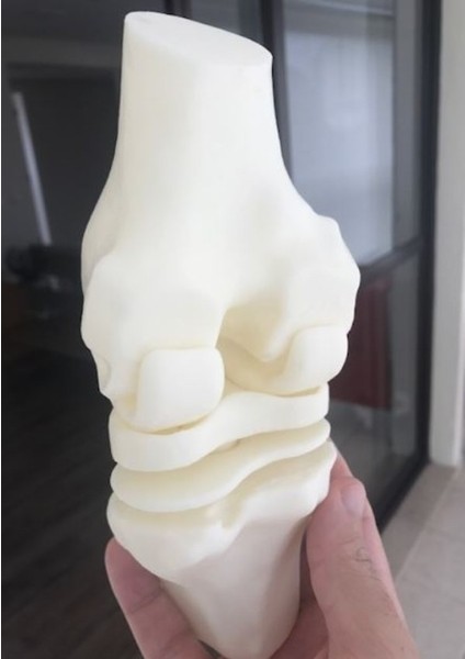 Diz Eklemi Modeli - Diz Eklemi Maketi