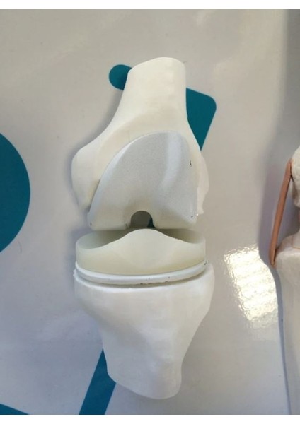 Diz Eklemi Modeli - Diz Eklemi Maketi modelleri