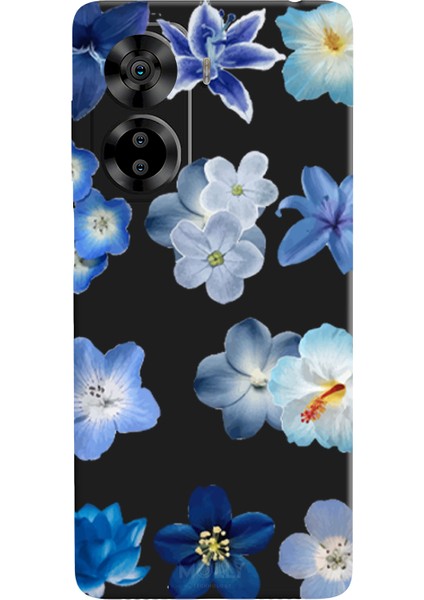 Casper Via X40 Için Siyah Azure Petals Desenli Silikon Kılıf