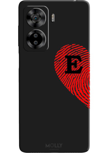 Casper Via X40 Için Siyah E Harfli Touch Of love Desenli Silikon Kılıf