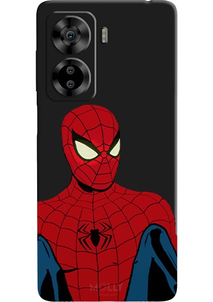 Casper Via X40 Için Siyah Retro Spider Desenli Silikon Kılıf