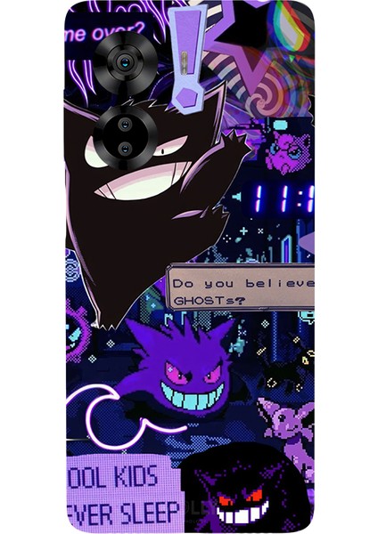 Casper Via X40 Için Siyah Midnight Glitch Desenli Silikon Kılıf