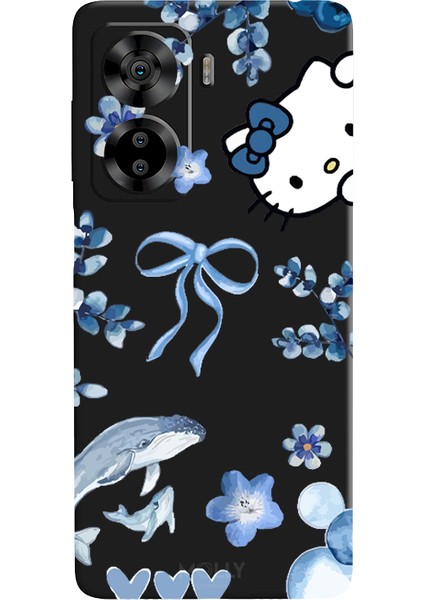 Casper Via X40 Için Siyah Blue Flow Kitty Desenli Silikon Kılıf
