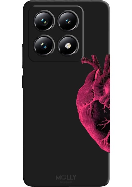 Xiaomi 14T Için Siyah Pink Heart Desenli Silikon Kılıf