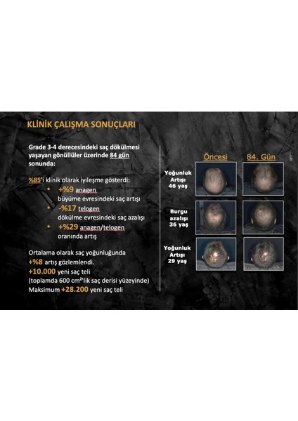 Hair Growth Volume Spray Saç Spreyi 125 ml fırsatları