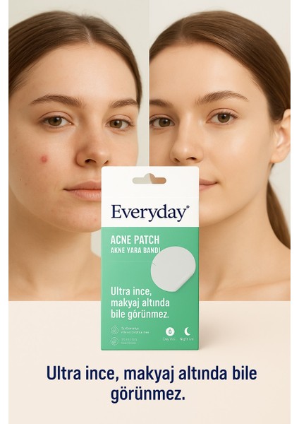 Hidrokolloid Acne Pimple Patch & Sivilce Yatıştırıcı Bant 36'lı - (2 li Paket 2*36 ) fırsatları