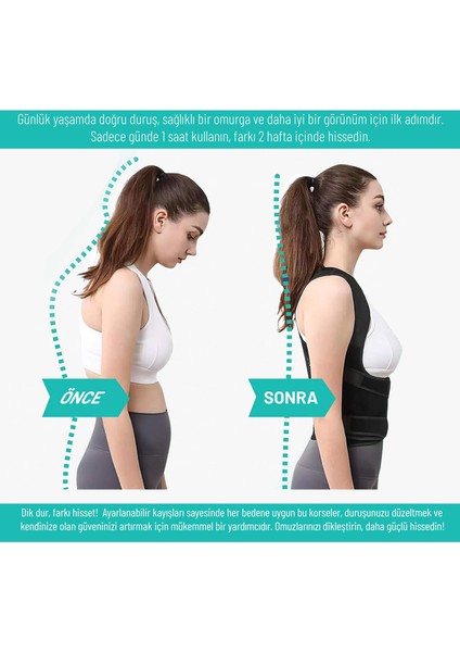 Medikal Dik Duruş Korsesi Sırt Korsesi Siyah Nefes Alabilir Kumaş ile Konforlu Kullanım fiyatları