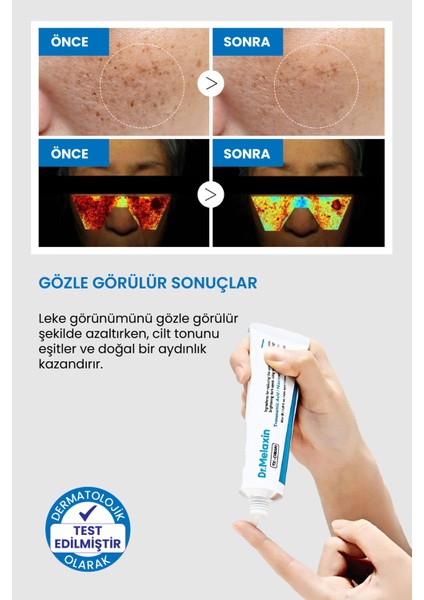 Koyu Leke Karşıtı & Yüz Kremi – Traneksamik Asit Glutatyon Niasinamid Içerikli Tx-Cream 50ML indirimleri