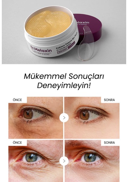 Kalsiyum Içerikli Göz Altı Pedi – | Rebornic Teknolojisi 60 Adet fiyatları