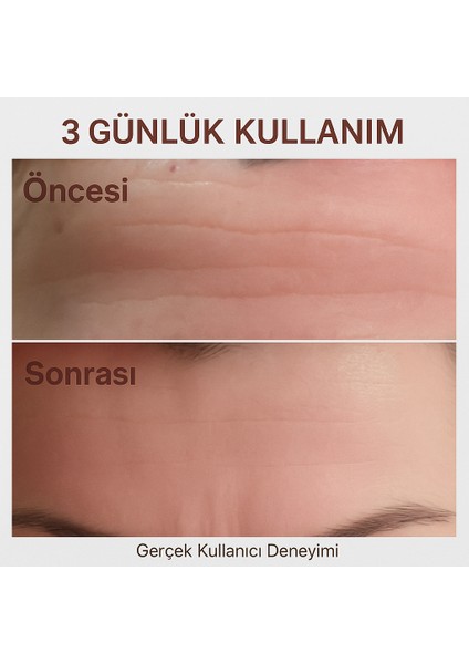 Yaşlanma Karşıtı Botoks Krem Anti-Aging Anti-Wrinkle Botox Cream 50 Ml fırsatları