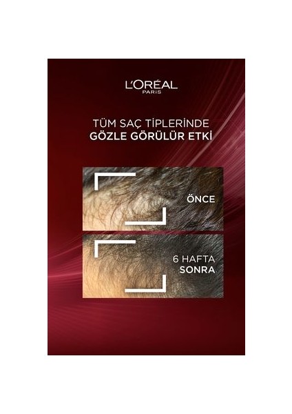 L'Oréal Paris Elseve Güçlendirici Şampuan - Koparak Dökülmeye Karşı Aminexil ve Biotin İçerir, 300 ml, Bitkisel Formül, Paraben İçermez