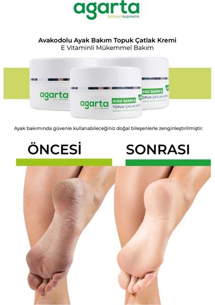 Ayak ve Topuk Çatlak Bakım Kremi 100ML (4 Lü Set) fırsatları