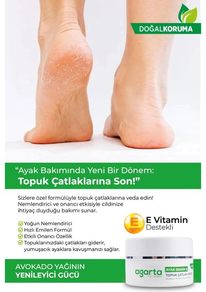 Ayak ve Topuk Çatlak Bakım Kremi 100ML (3 Lü Set) indirimleri