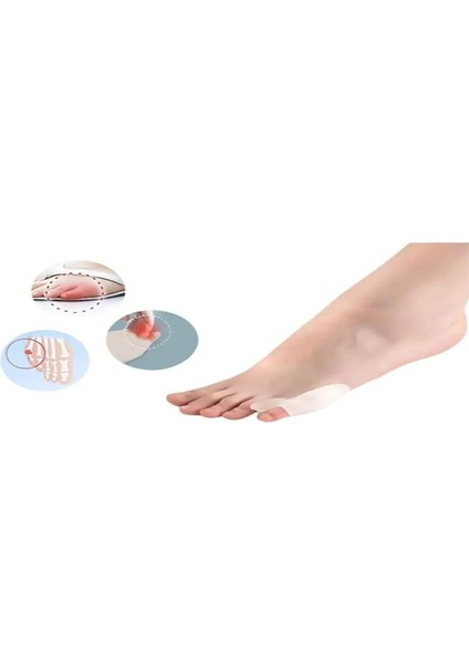 Ayak Parmak Bunyonu Ayak Serçe Parmağı Ayırıcı Bunyon 1 Çift Kemik Koruyucu Silikon fırsatları
