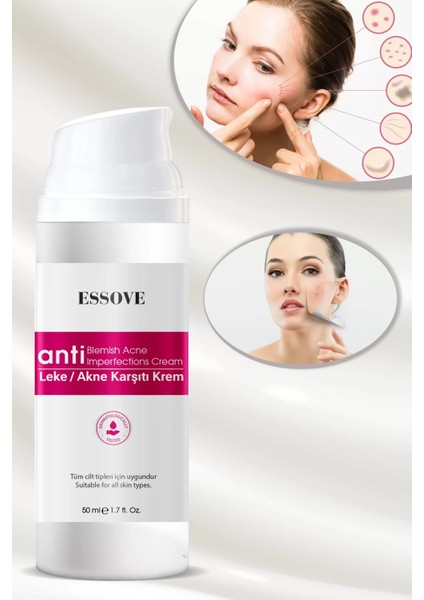 essove krem 50ml modelleri
