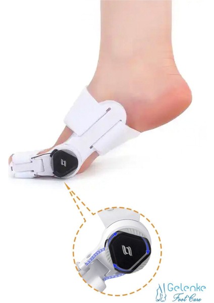 ayarlı baş parmak kemik düzeltici - halluks - baş parmak eğriliği düzeltme