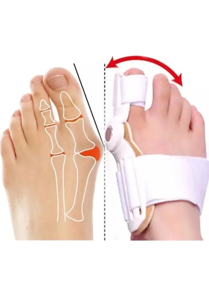 Halluksvalgus Ayak Baş Parmak Kemik Eğriliği Çıkıntı Düzeltici Tekli