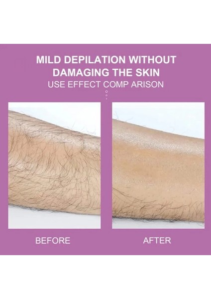 Epilatör Kristal Epilasyon Aleti modelleri