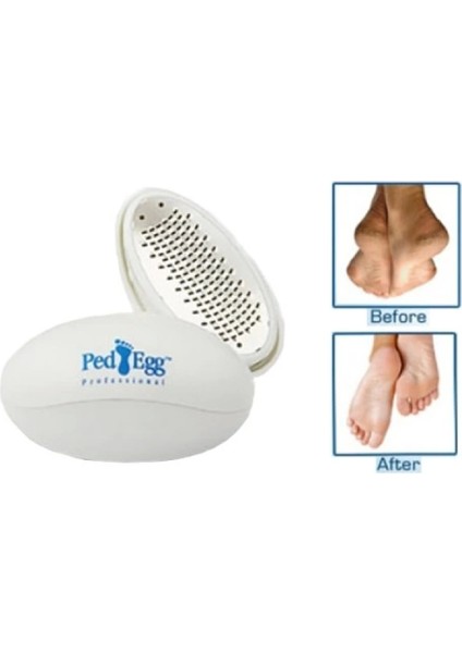 Ped Egg Topuk Törpüsü