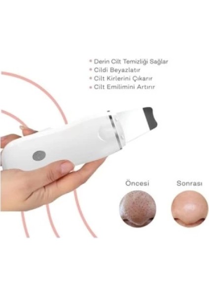Ultrasonik Spatula Yüz Akne Gideerici Siyah Nokta Temizleme Cihazı fiyatları