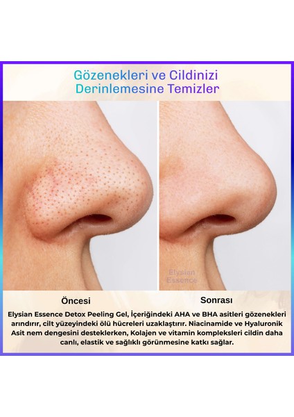Detox Peeling Jel 3'lü Set | Ölü Hücre Arındırıcı Temizleme jeli | Yüz Ve vücut temizleyici | aha bha, Vitamin C, Niacinamide modelleri